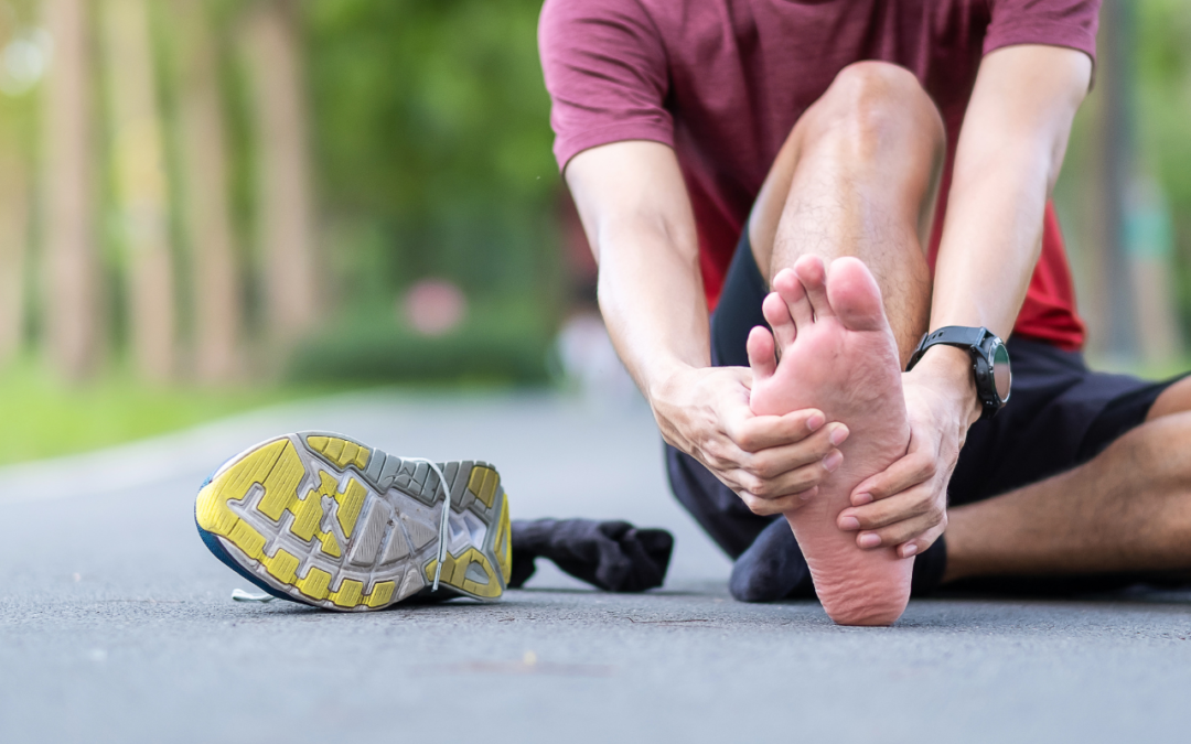 Fascite plantare tempi di guarigione e l’approccio osteopatico